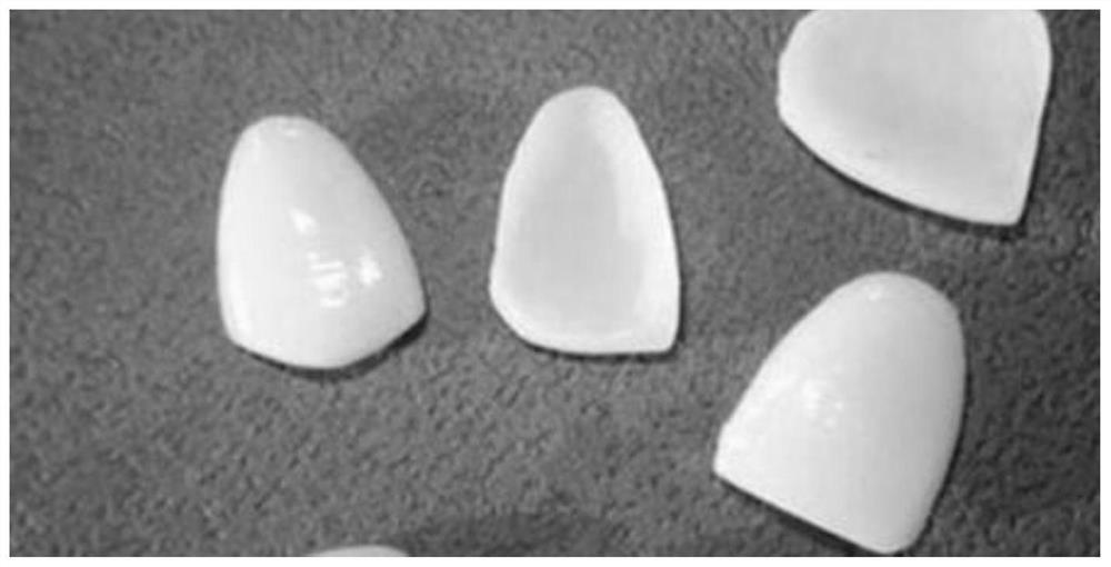 Glass-ceramic veneer and its processing method