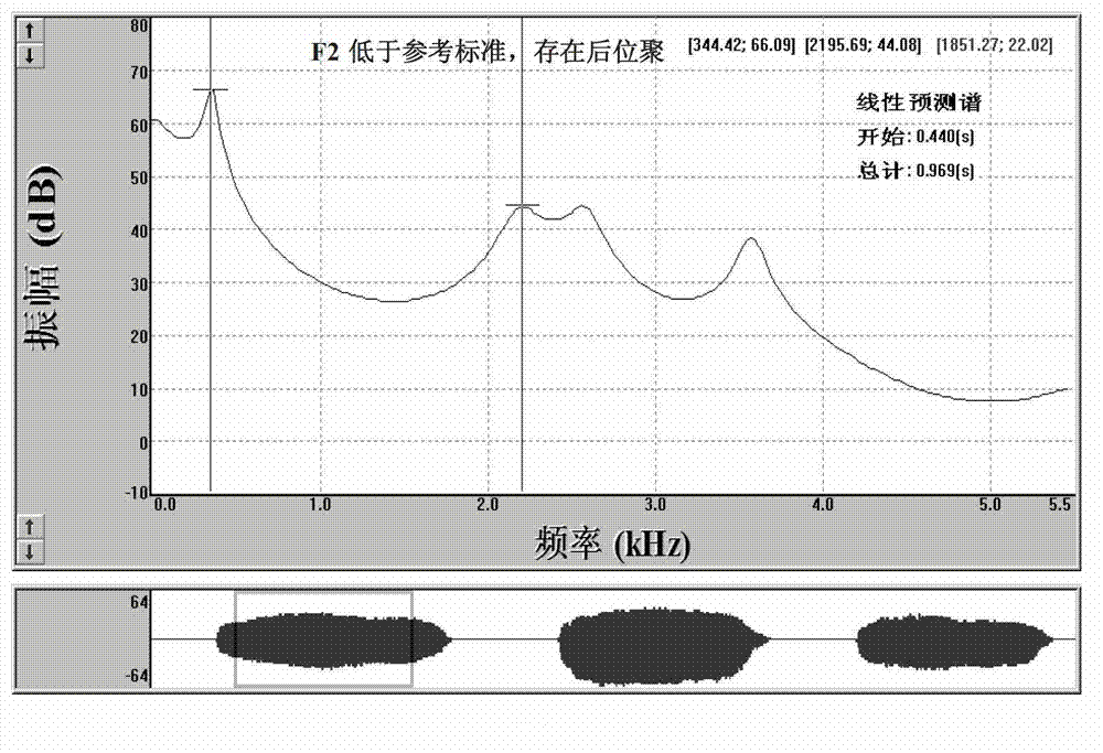 Rehabilitation system and method based on real-time audio-visual feedback and promotion technology for speech resonance