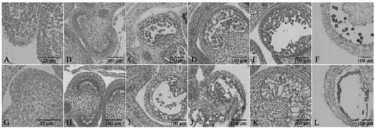 Identification of capsicum annuum CMS male sterility gene Ca06g18730 based on fertility differential protein and application