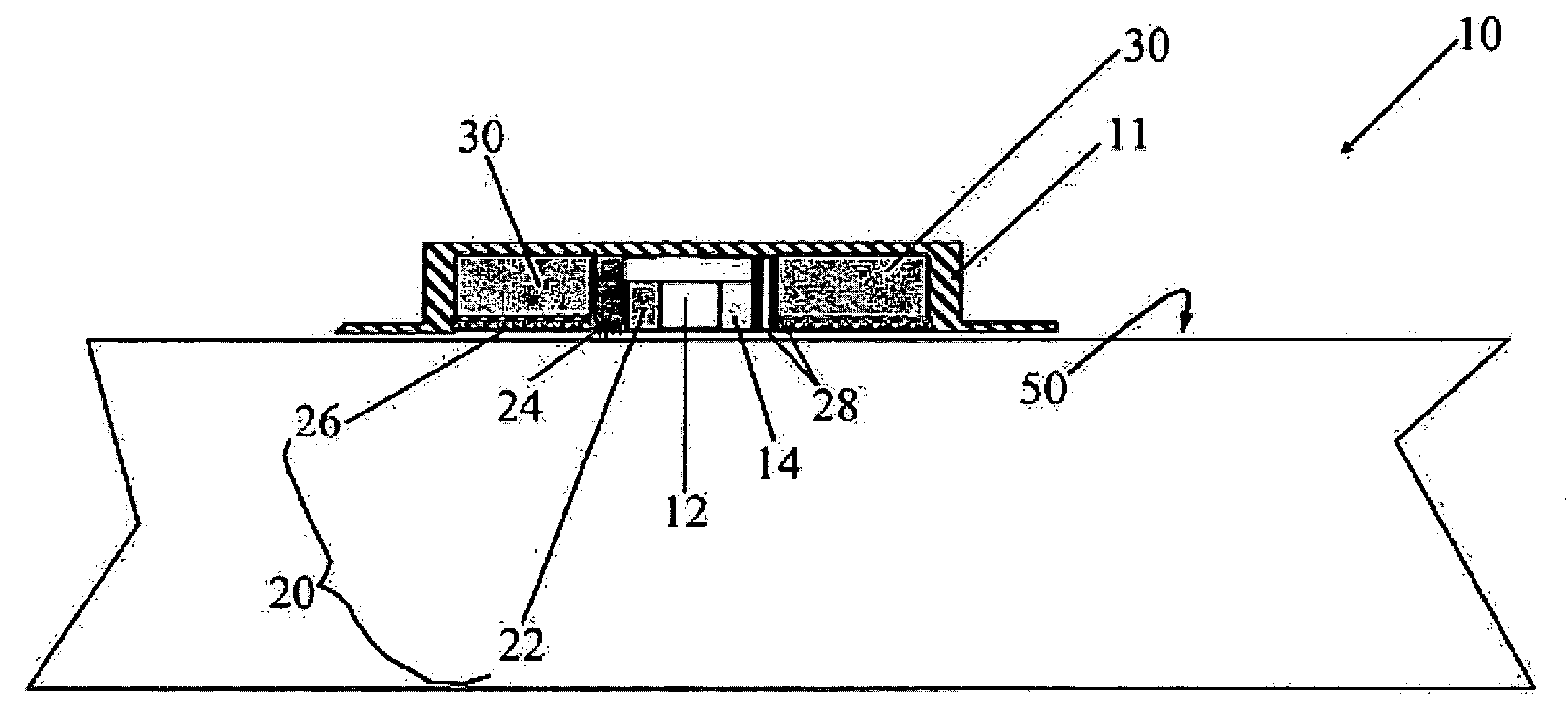 Medical device for delivering drug and/or performing physical therapy