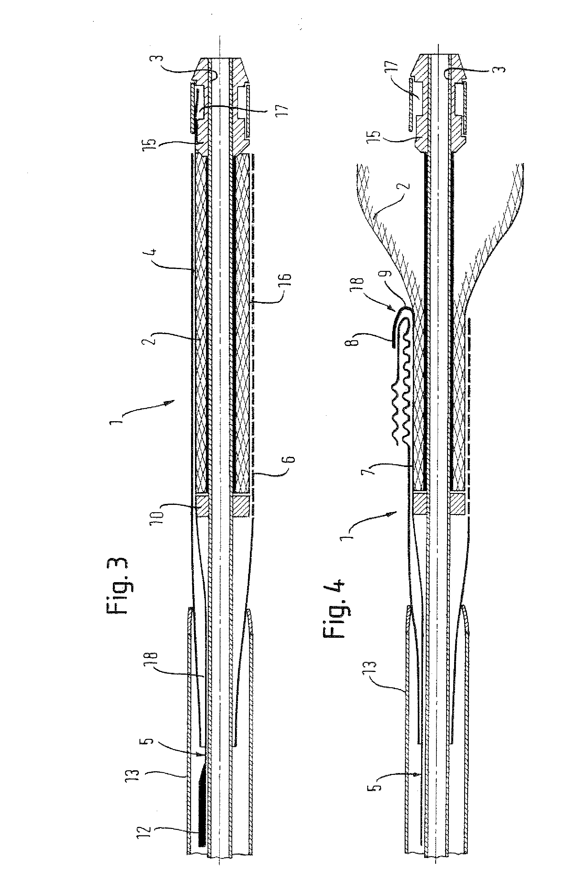 Stent Delivery Device