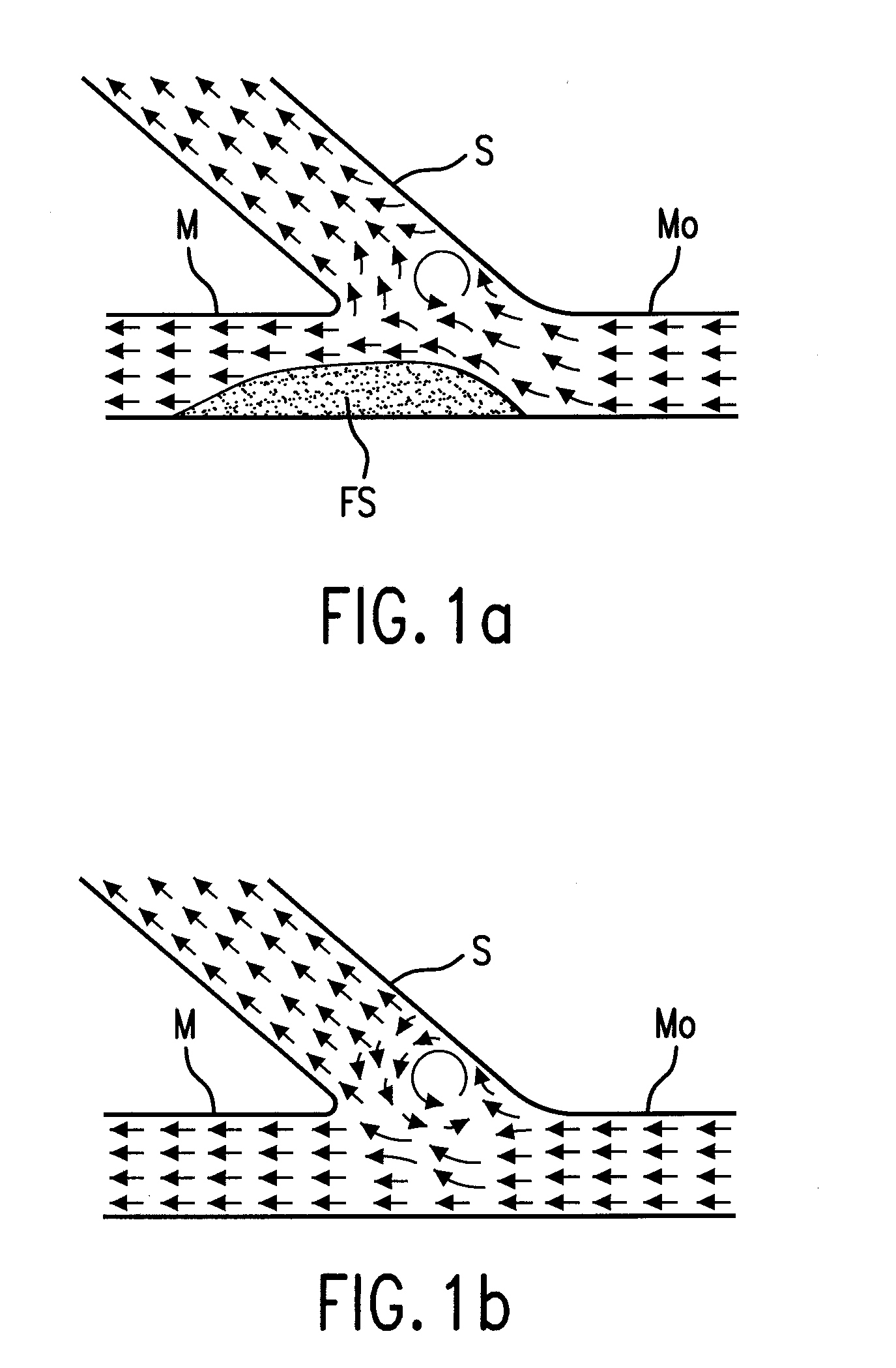 Method and apparatus for stenting