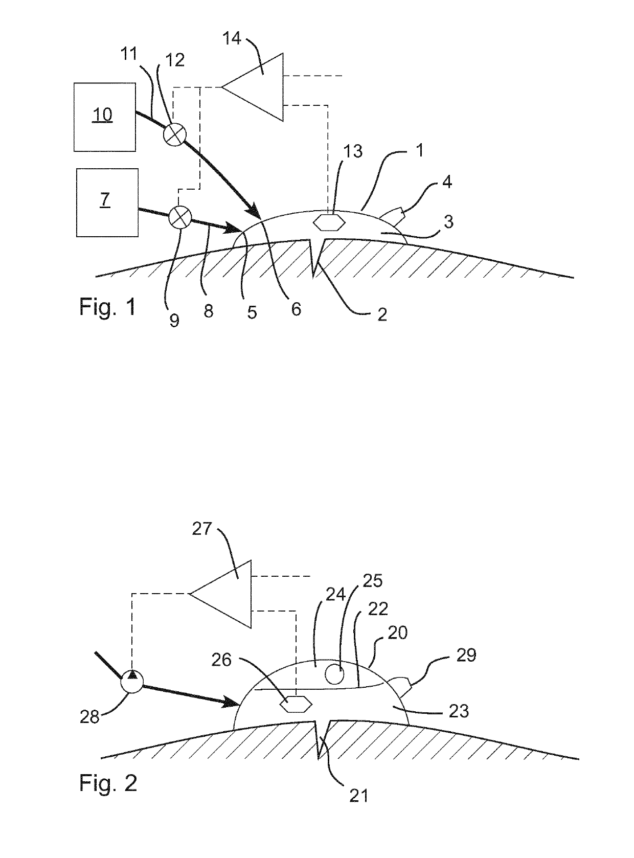 System for reduced scarring of wounds