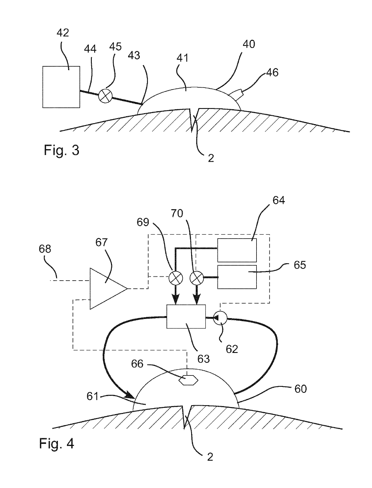 System for reduced scarring of wounds