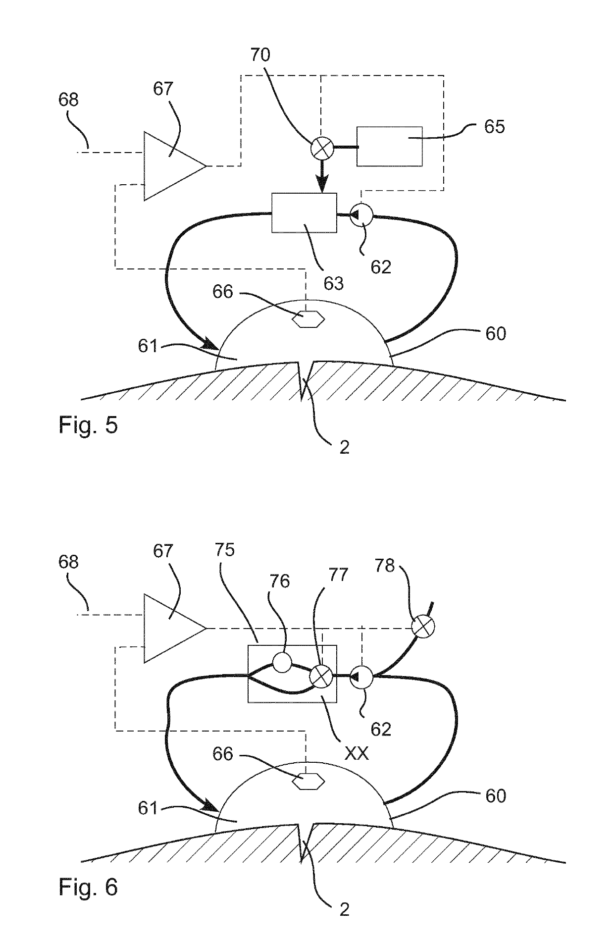 System for reduced scarring of wounds