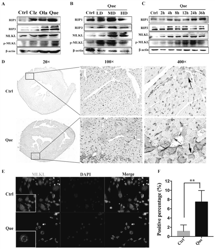 Application of cannabinoid receptor drug in preparation of drug for treating myocardial cell necrosis apoptosis