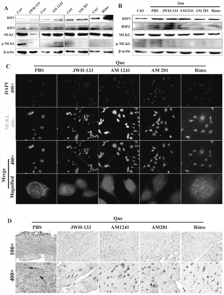 Application of cannabinoid receptor drug in preparation of drug for treating myocardial cell necrosis apoptosis