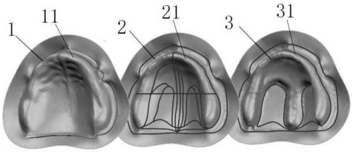 High-simulation maxillary edentulous jaw soft and hard tissue in-vitro model and preparation method thereof