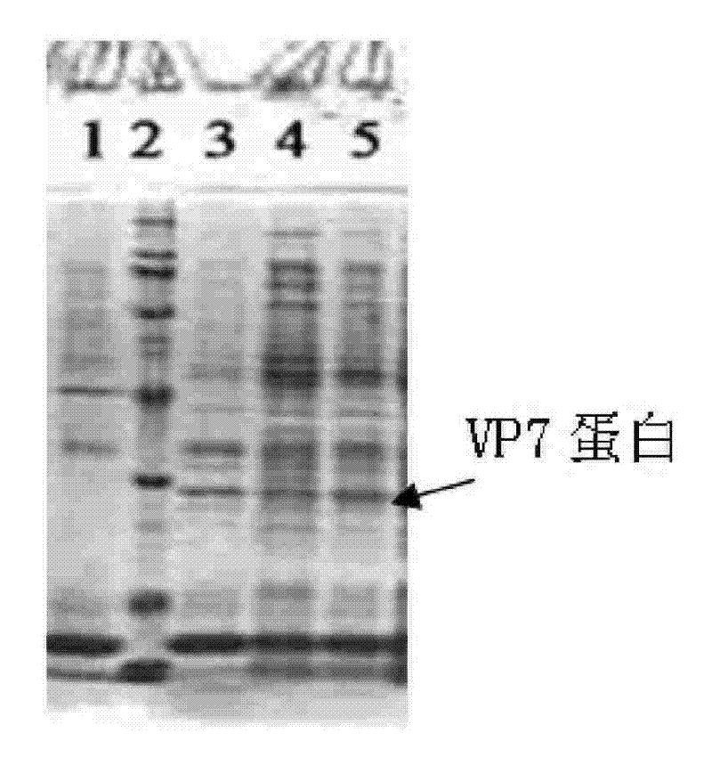Recombined bifidobacteria -hRV/VP7 expression vector and oral vaccine thereof
