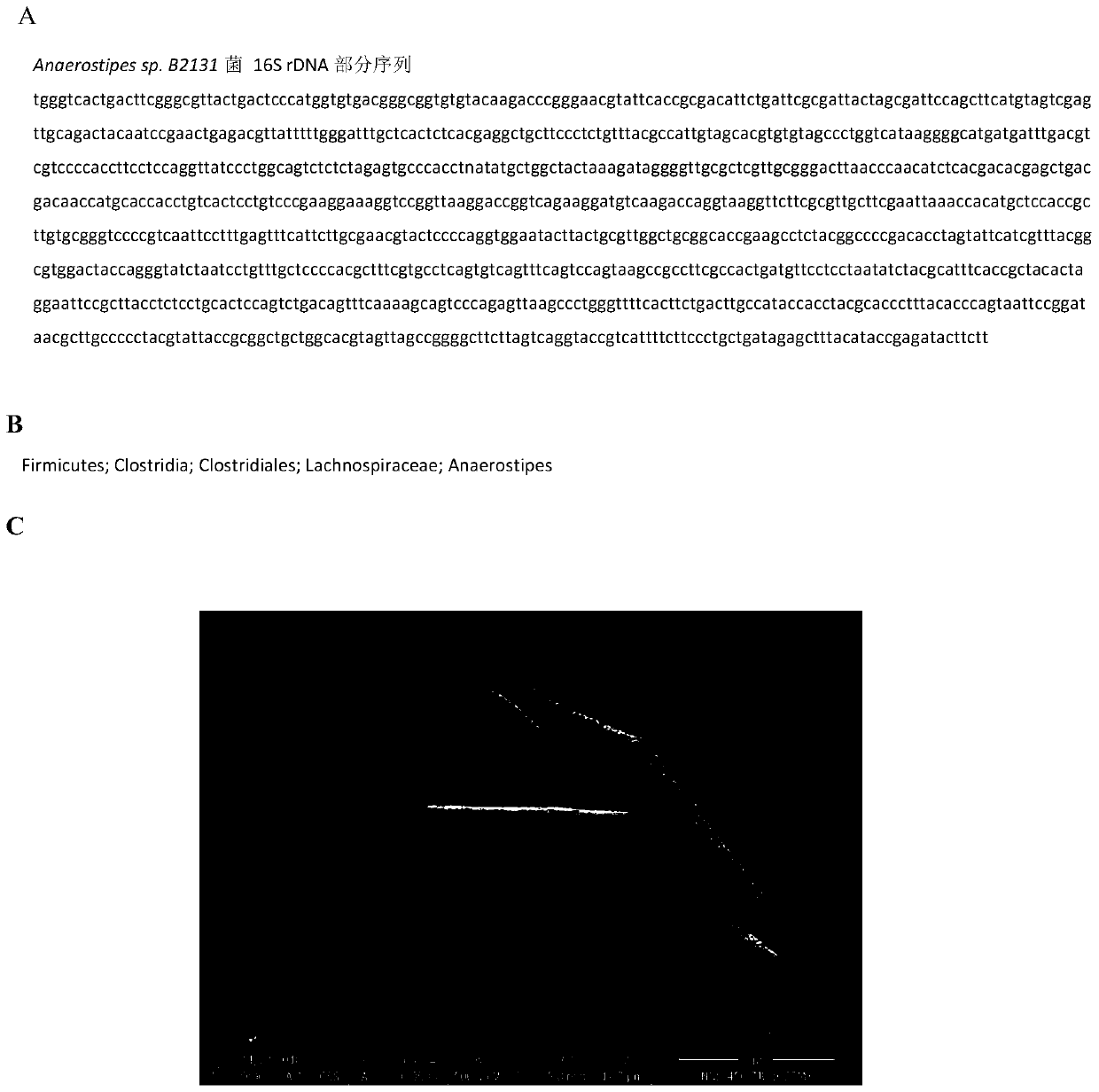 Strain Anaerostipes sp B2131 and application thereof in inflammatory intestinal diseases