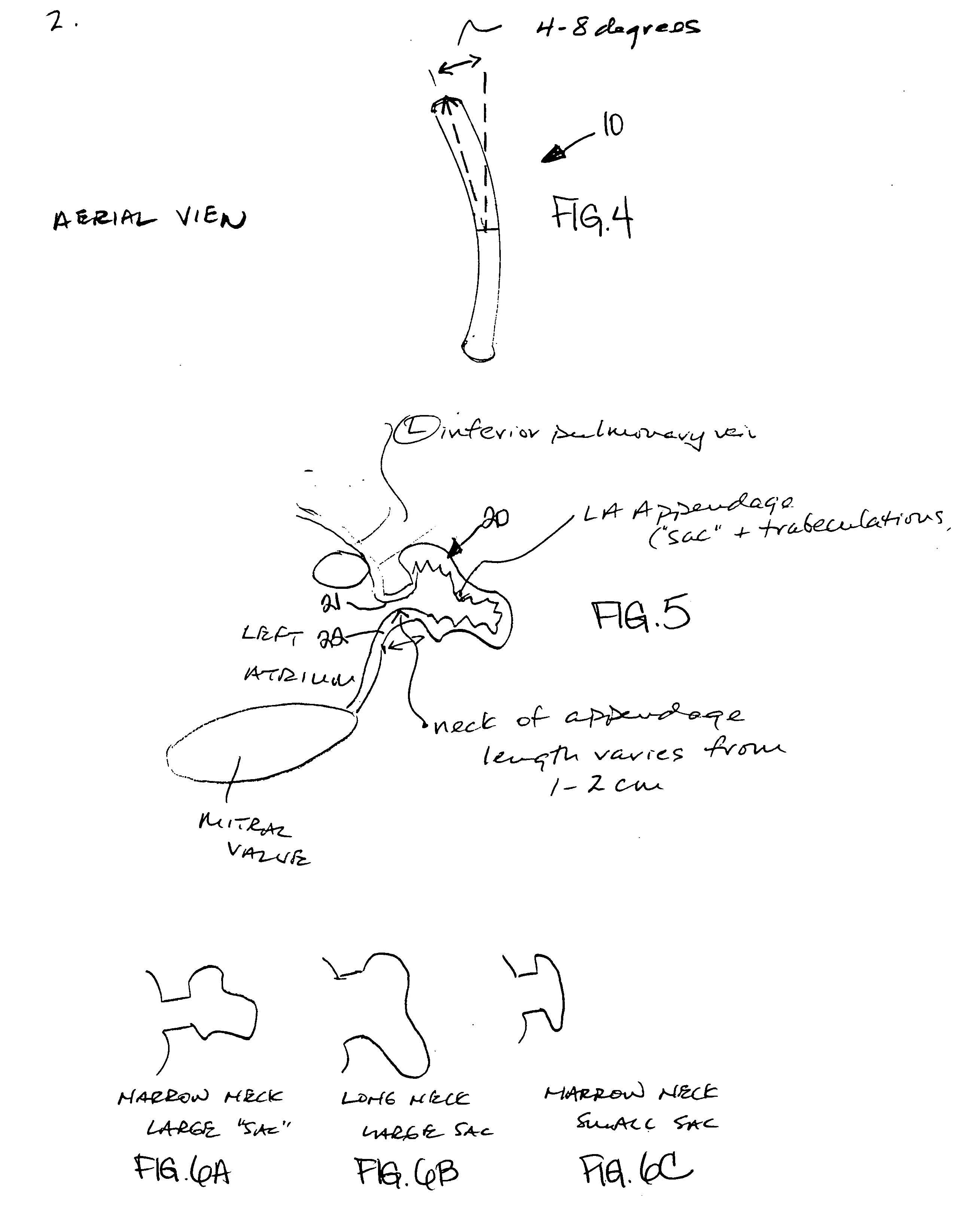 Atrial tissue fixation device