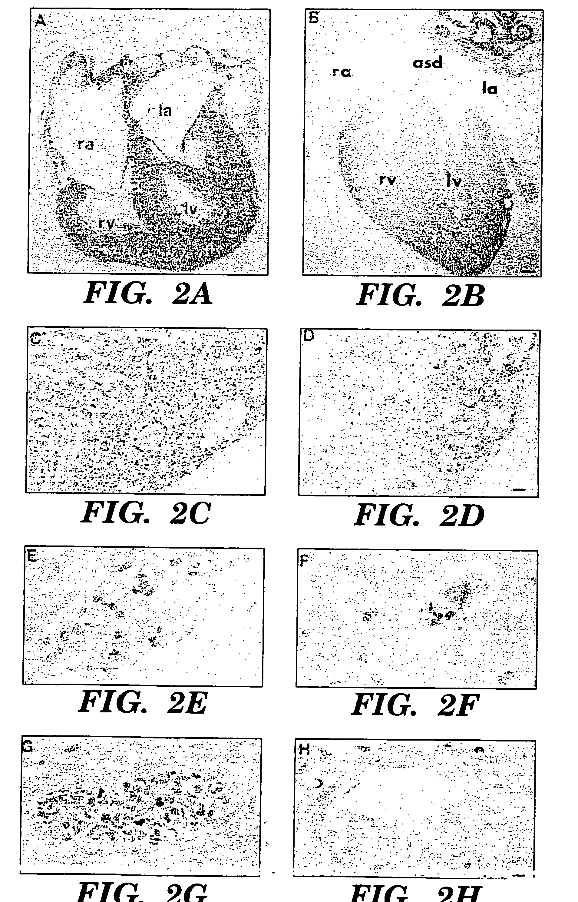 Methods for regulating angiogenesis and vascular integrity using trk receptor ligands