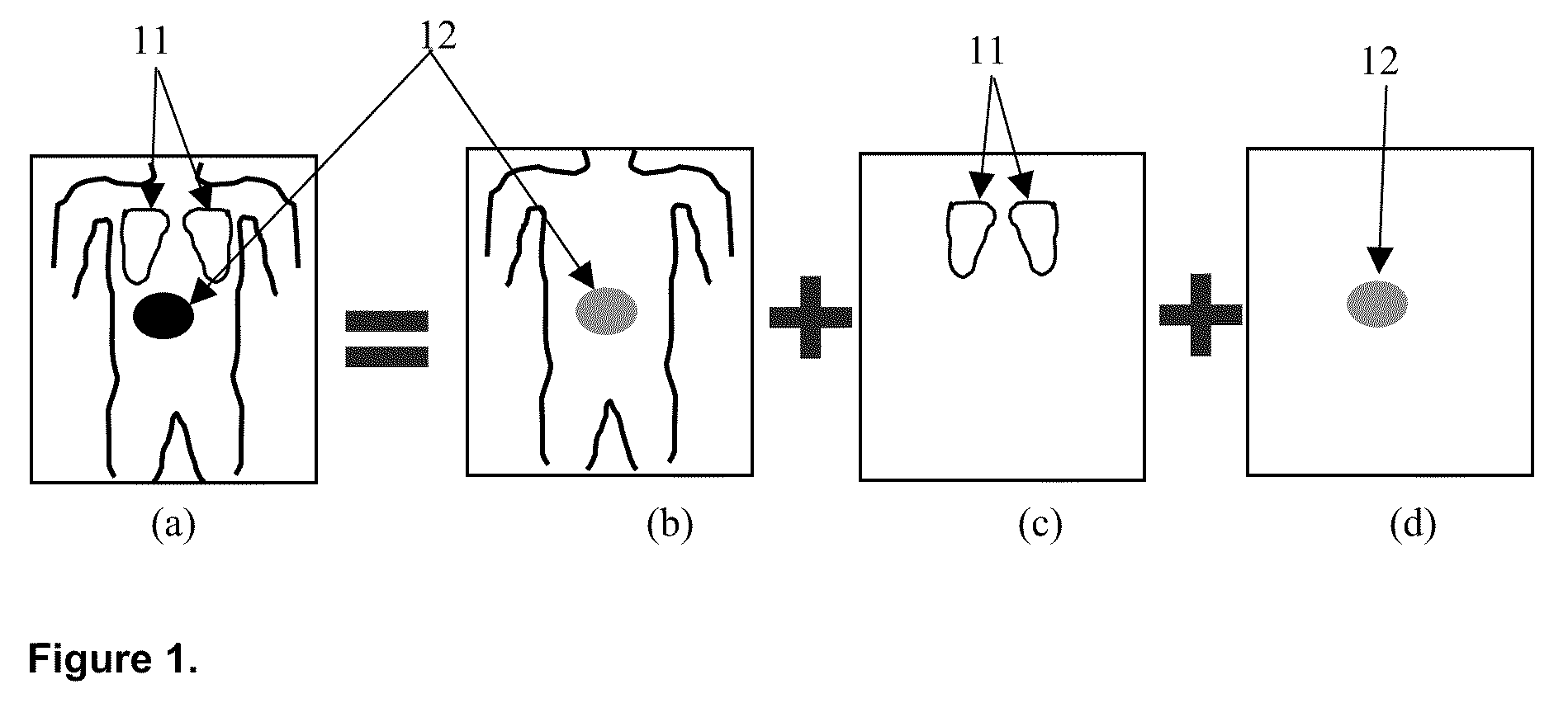 System and Method for Additive Spatial/Intensity Decomposition of Medical Images