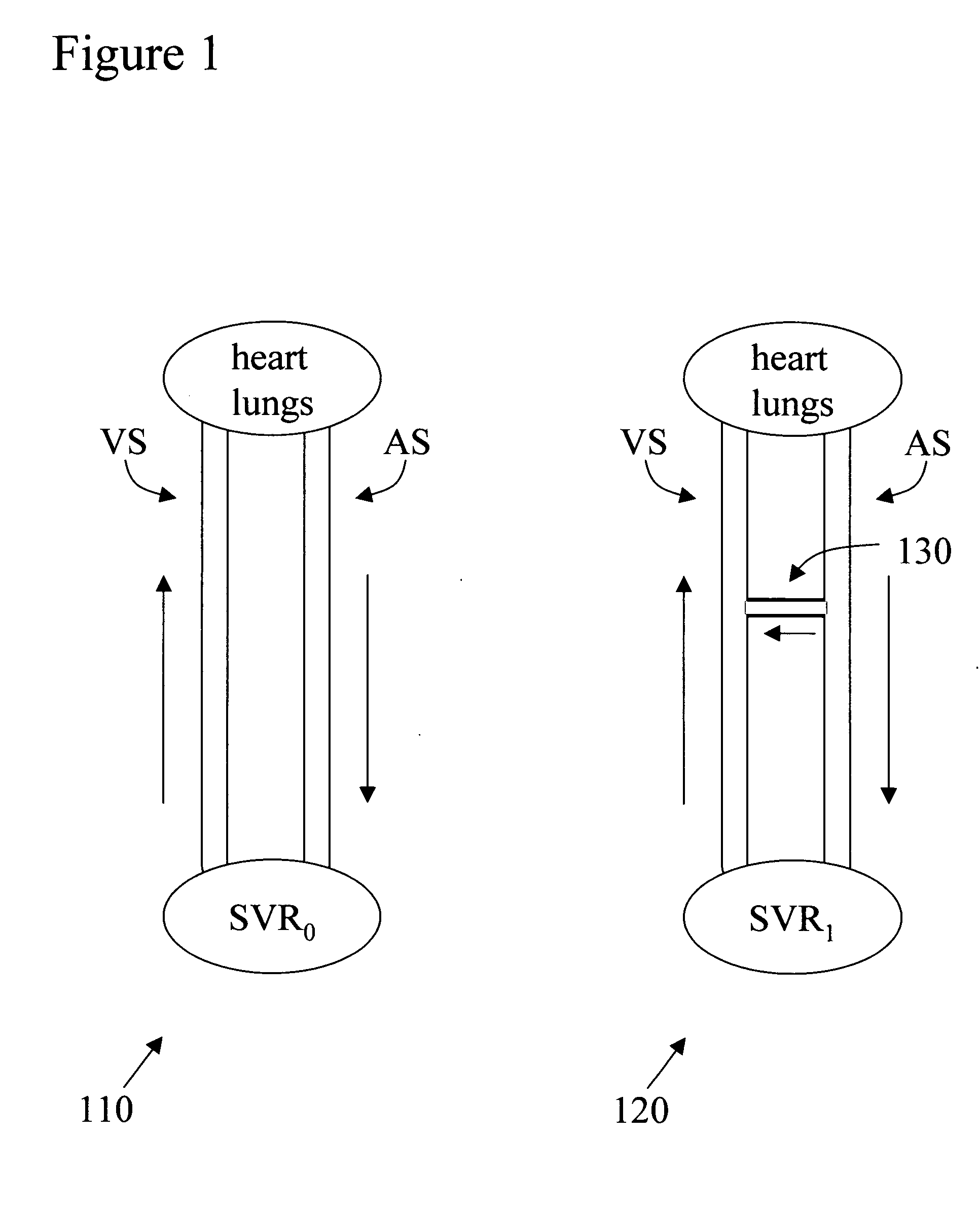 Implantable arterio-venous shunt devices and methods for their use