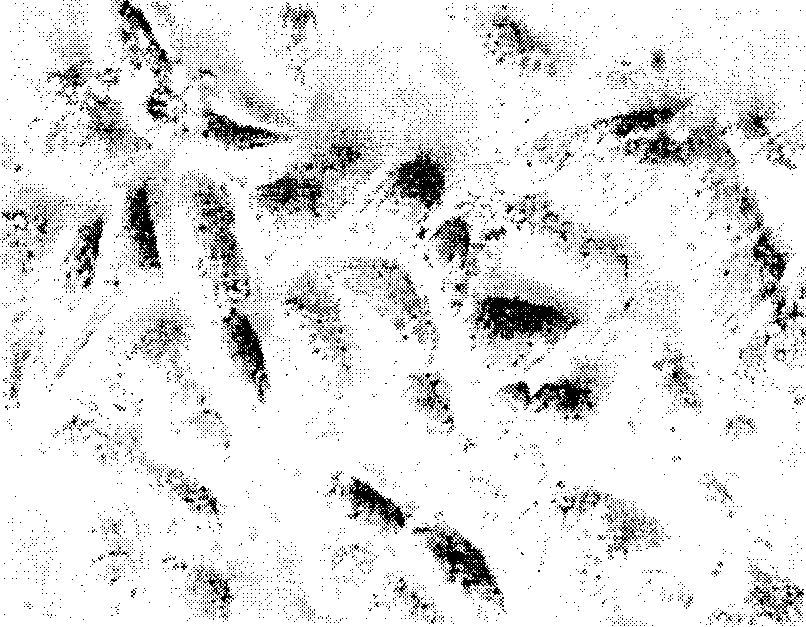 Vinorelbine solid lipid nano granule, freeze drying formulated product and method of preparing the same