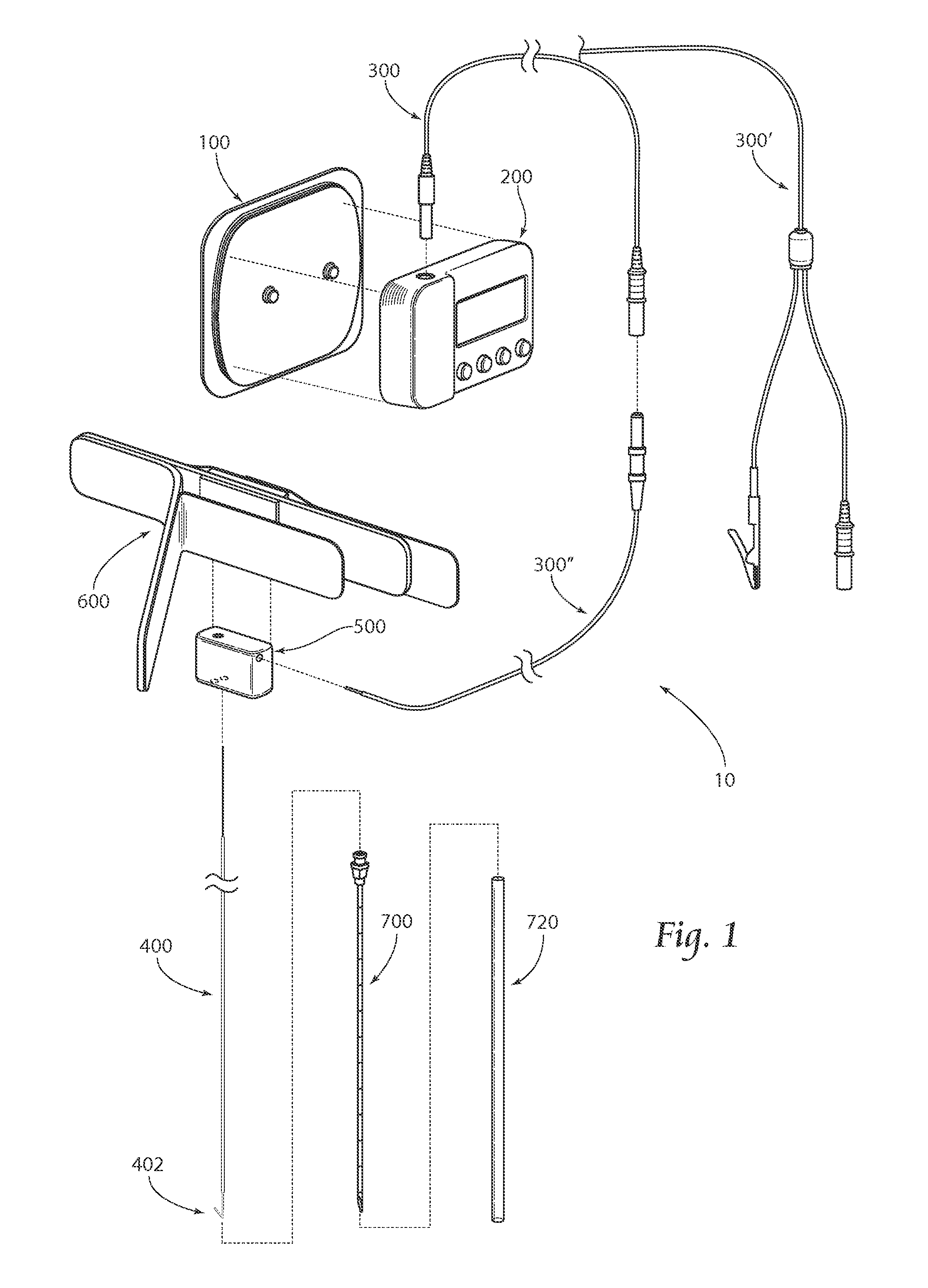 Systems and methods for percutaneous electrical stimulation