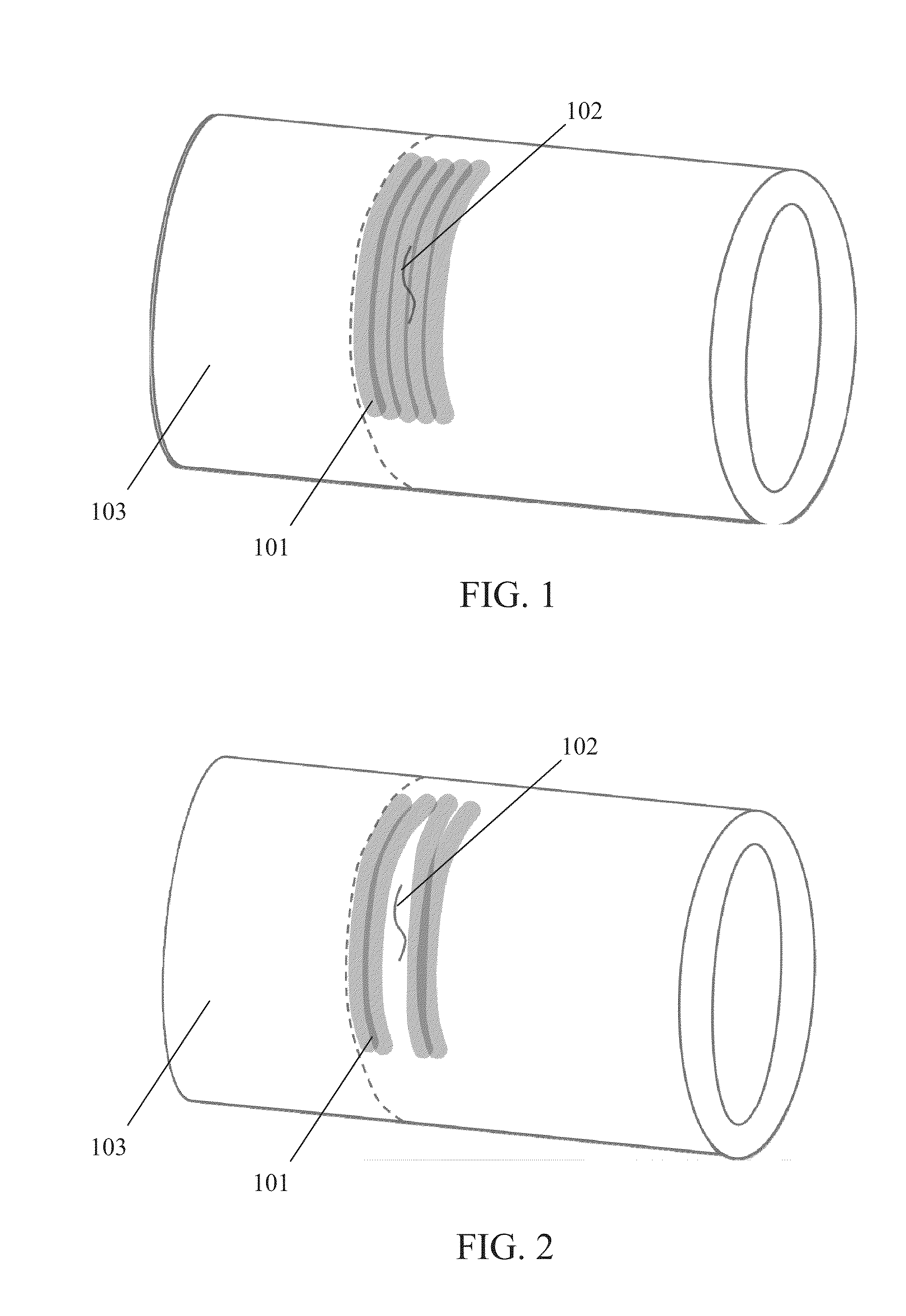 Stereo Vision Encoded Ultrasonic Inspection