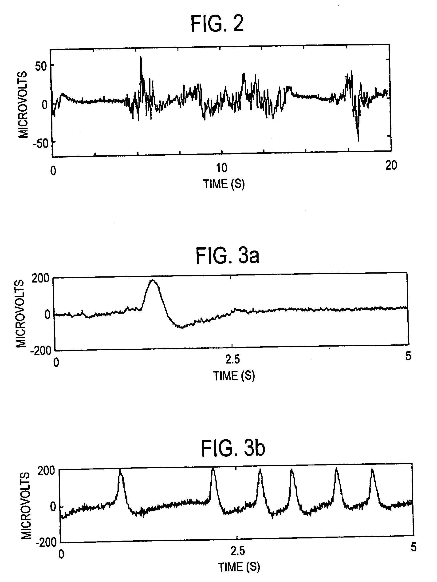 Method and apparatus for determining the cerebral state of a patient using generalized spectral entropy of the EEG signal