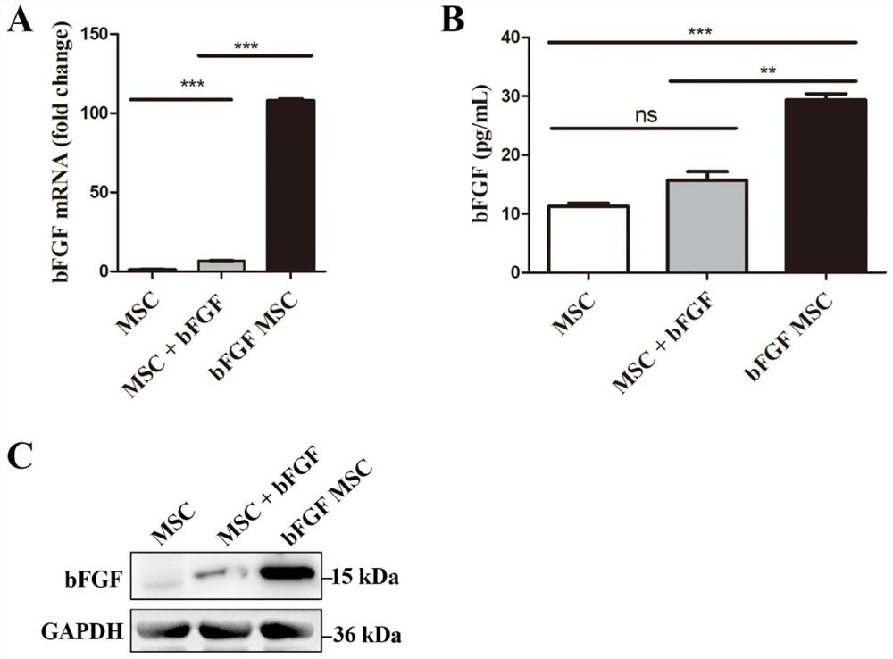 BFGF mesenchymal stem cell exosomes and preparation method and application thereof