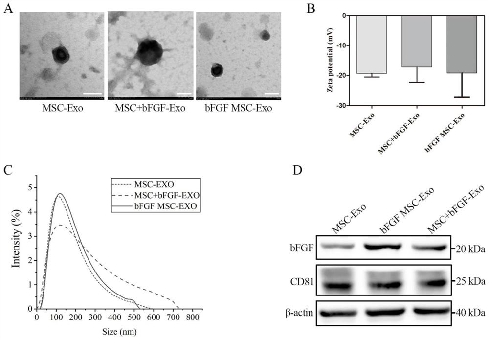 BFGF mesenchymal stem cell exosomes and preparation method and application thereof