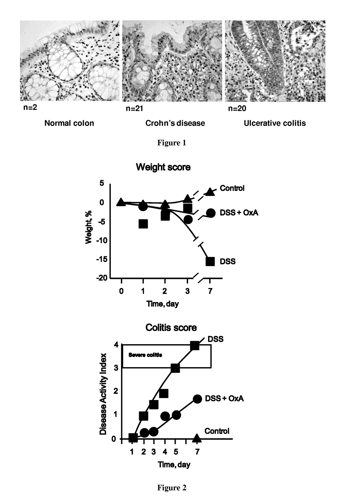 Pharmaceutical compositions comprising agonists of orexin-1 receptor ox1r for the treatment of inflammatory bowel diseases