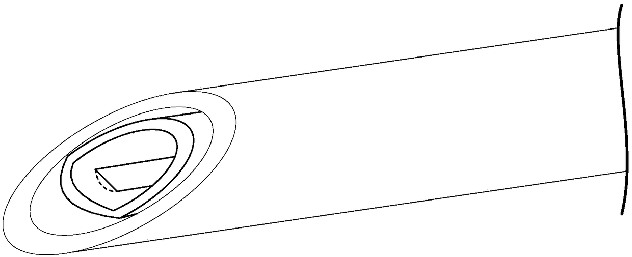 Anterior cruciate ligament attachment avulsion fracture puncture fixation thread device