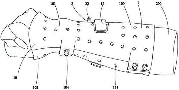 External fixed bracket assembly for promoting bone healing