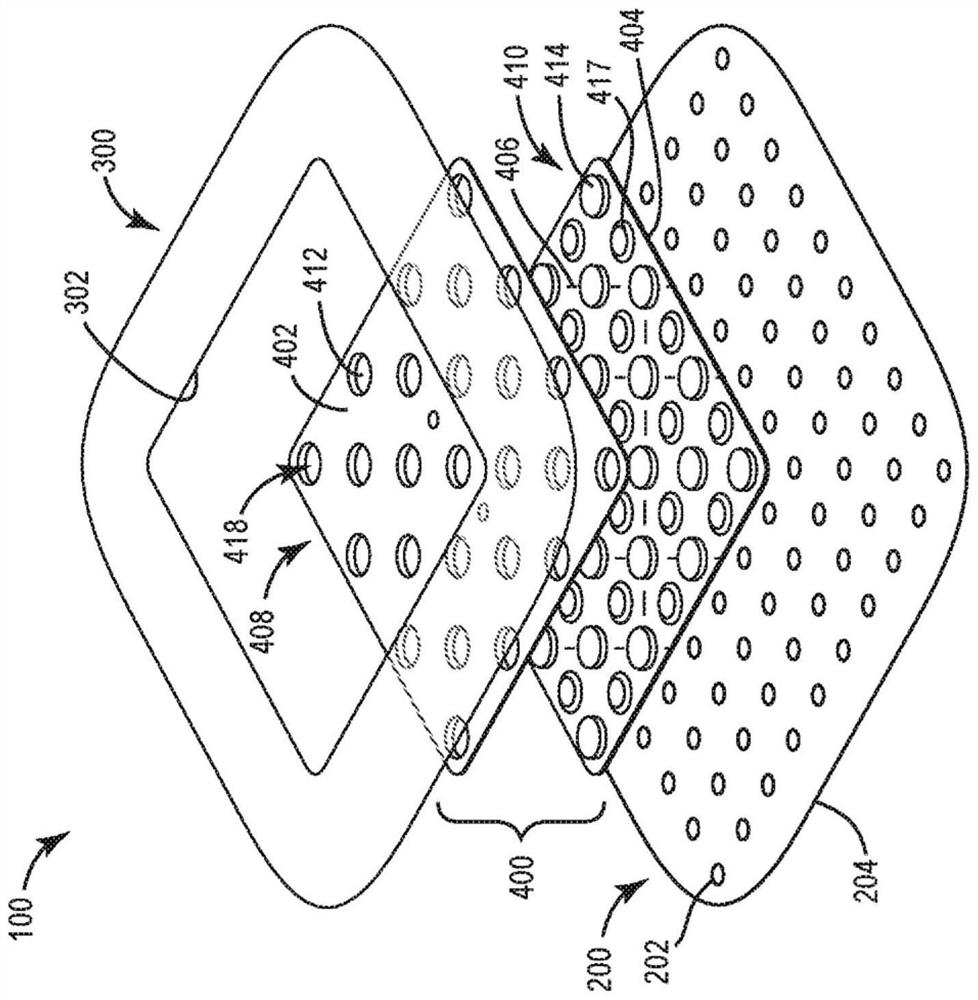 Partially transparent wound dressing