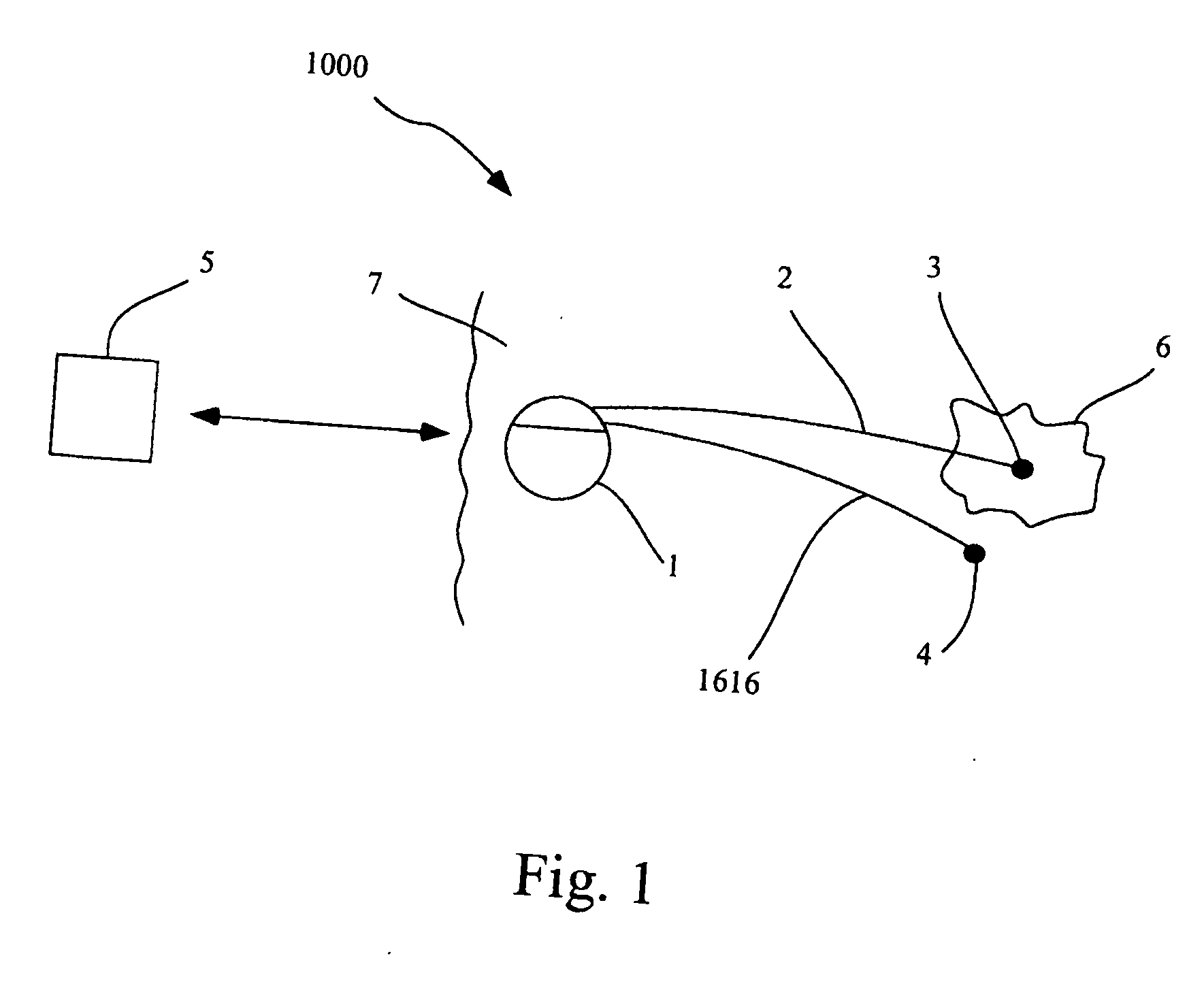 Method and Device for Treating Abnormal Tissue Growth With Electrical Therapy