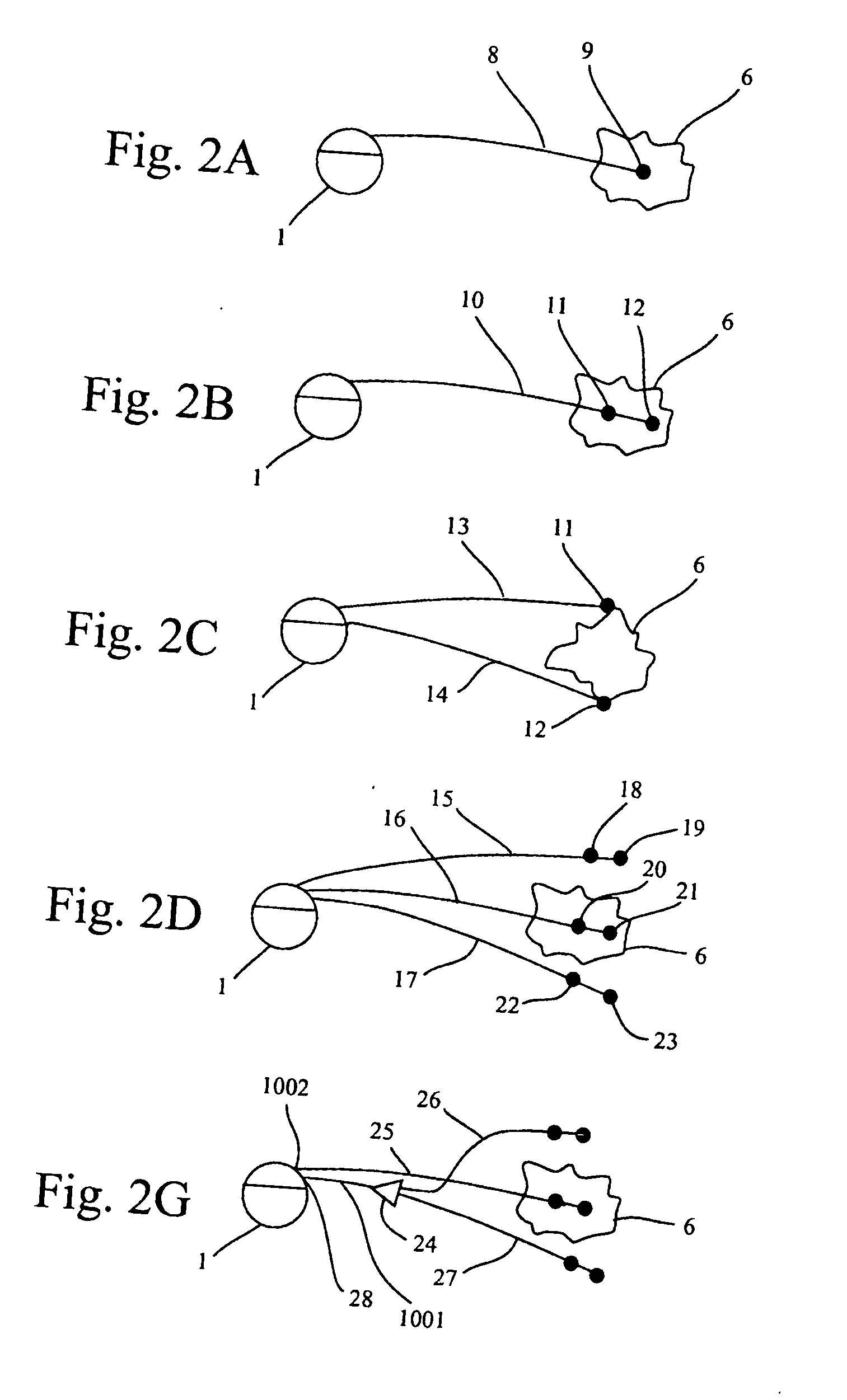 Method and Device for Treating Abnormal Tissue Growth With Electrical Therapy