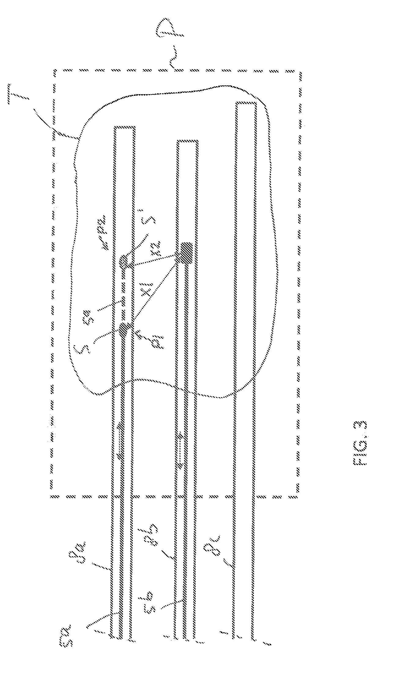 Afterloading device, and use thereof
