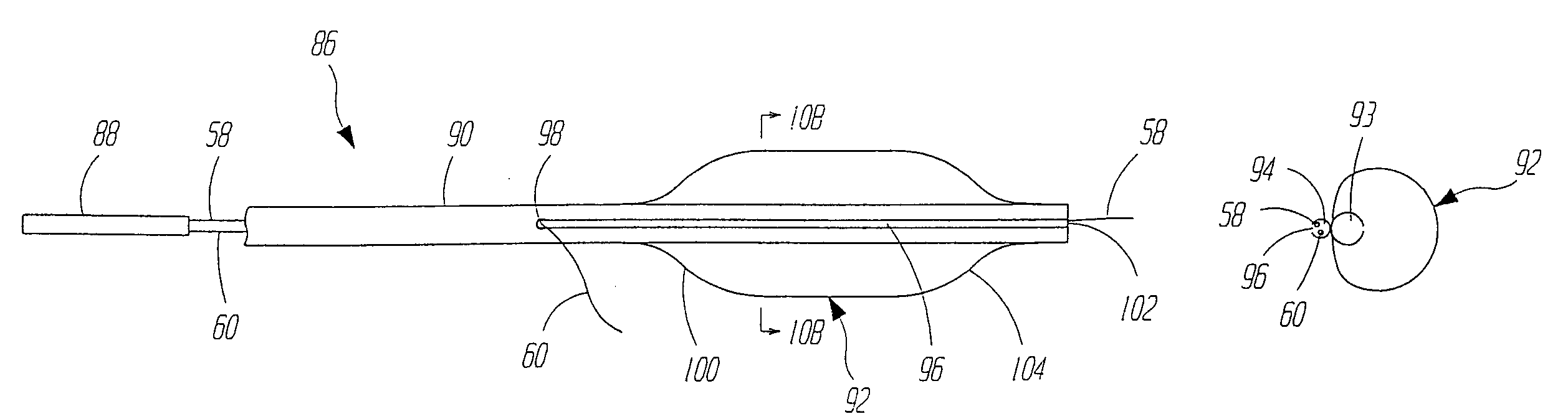 Dilation and stent delivery system for bifurcation lesions