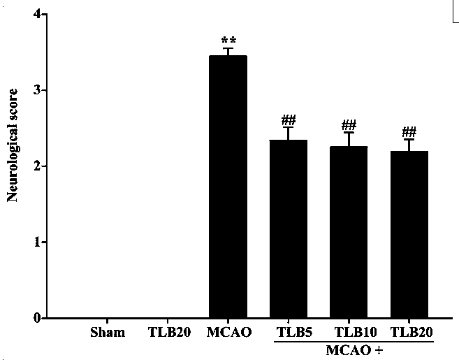 Application of trilobatin to cerebral ischemia-reperfusion injury preventing and treating drug