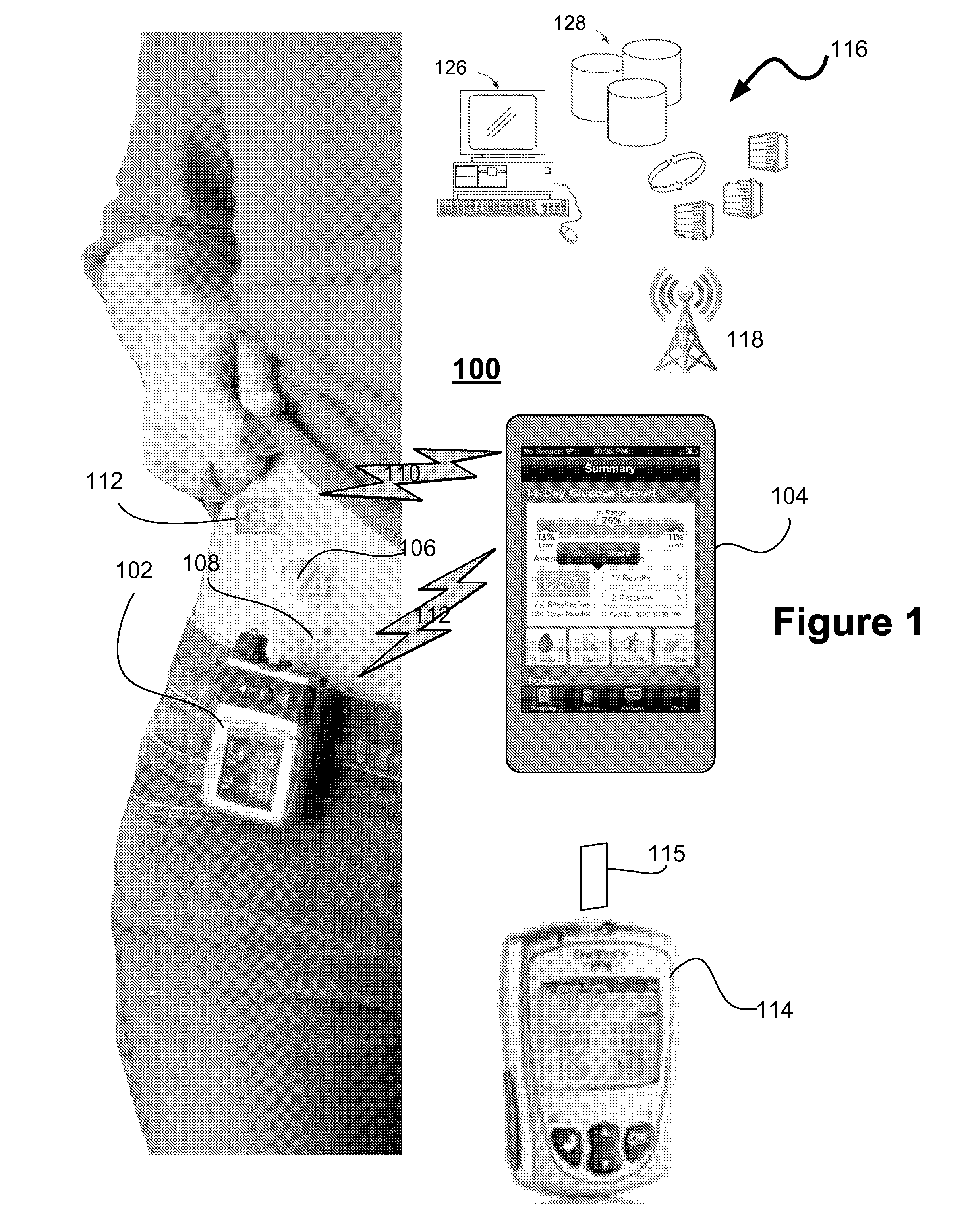 Method and system for controlling a tuning factor due to sensor replacement for closed-loop controller in an artificial pancreas