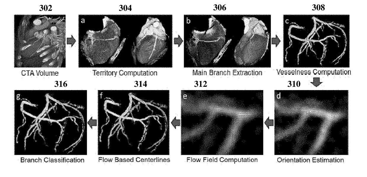 Method and System for Extracting Centerline Representation of Vascular Structures in Medical Images Via Optimal Paths in Computational Flow Fields