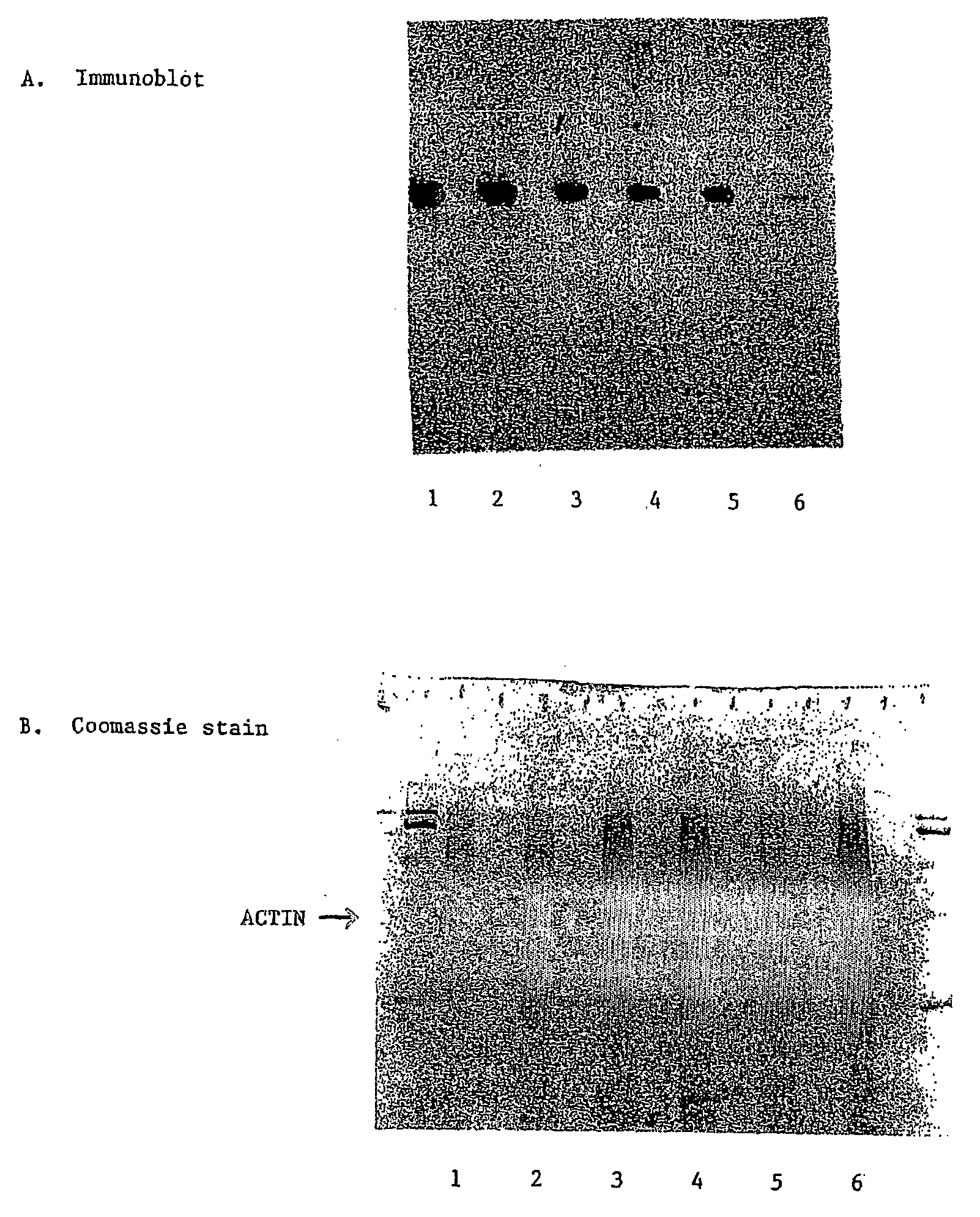 Diagnosis Of Primary Open Angle Glaucoma