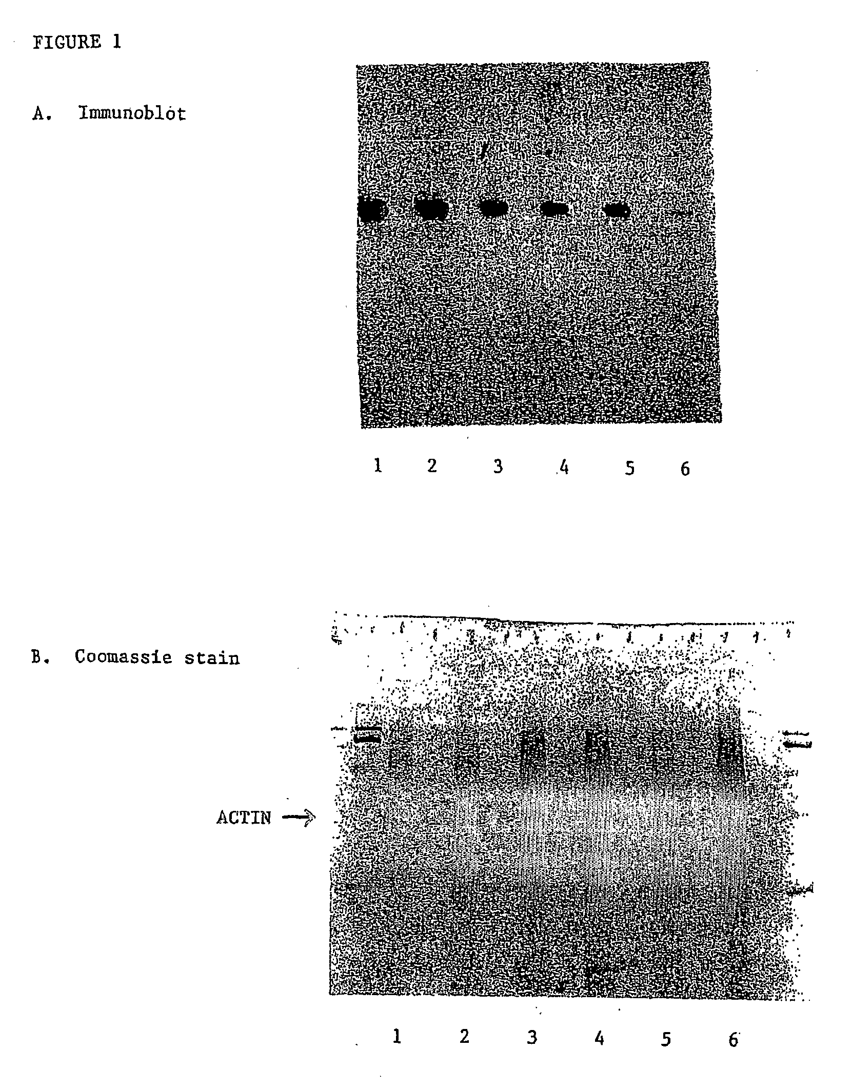 Diagnosis Of Primary Open Angle Glaucoma