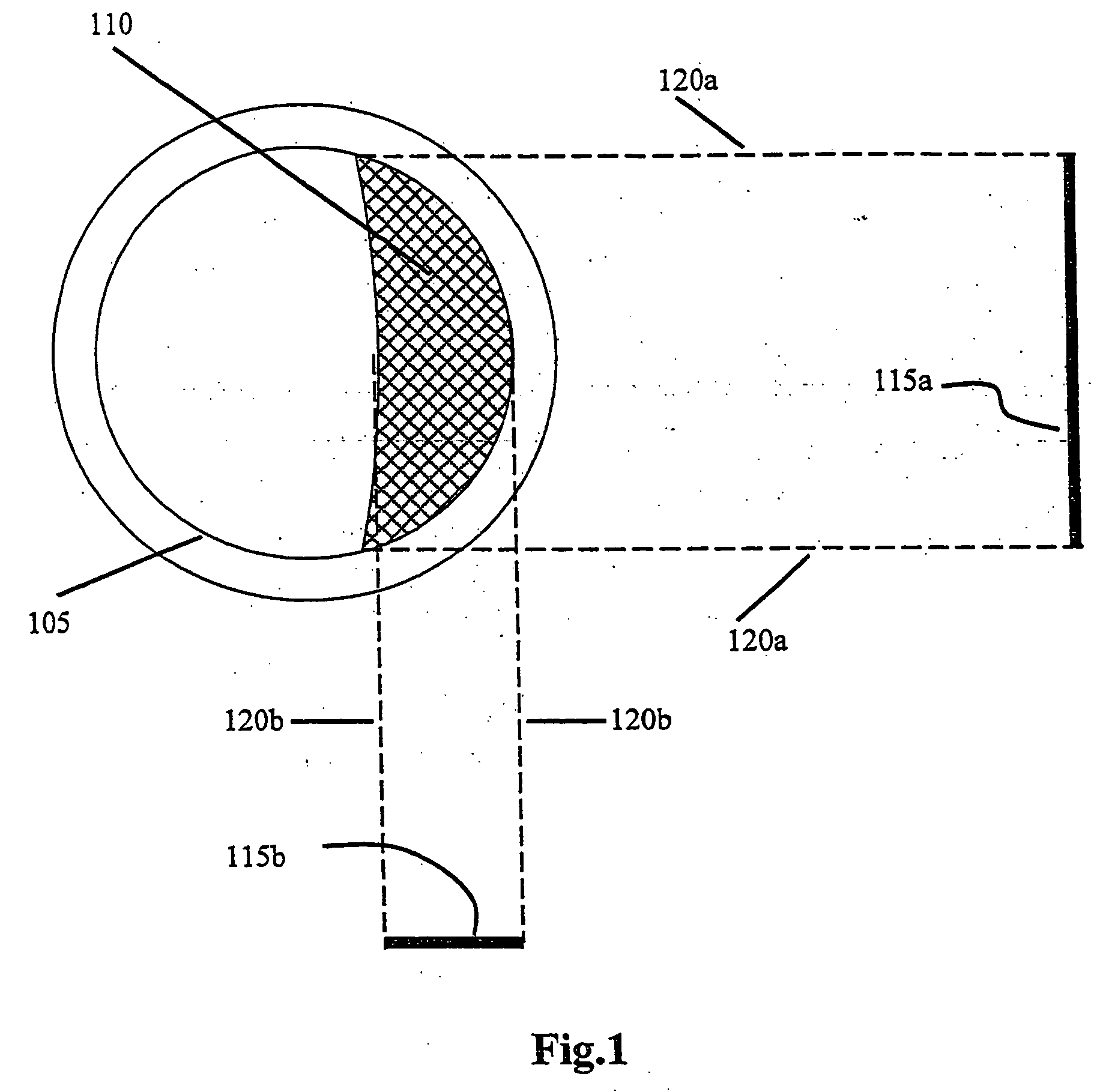 System and method for three-dimensional reconstruction of an artery