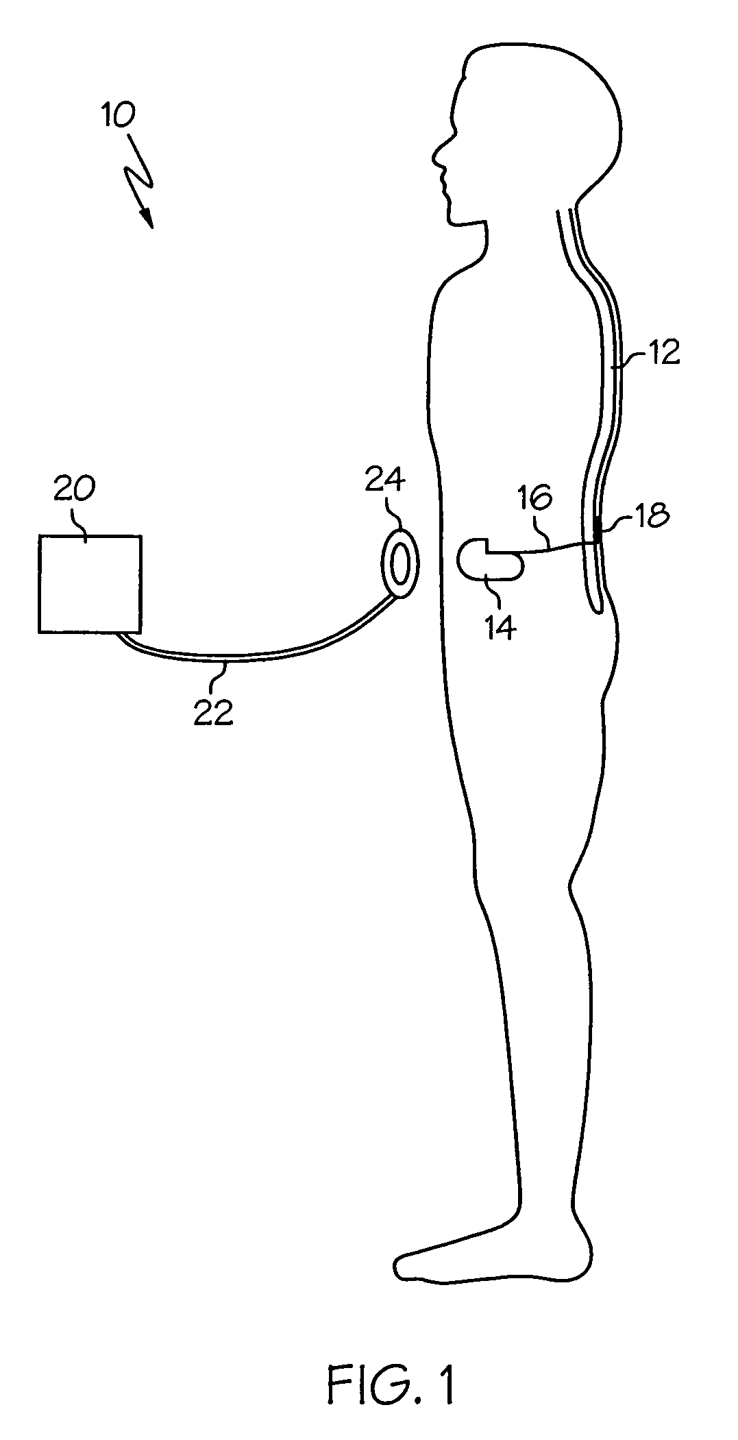 Medical lead and manufacturing method therefor