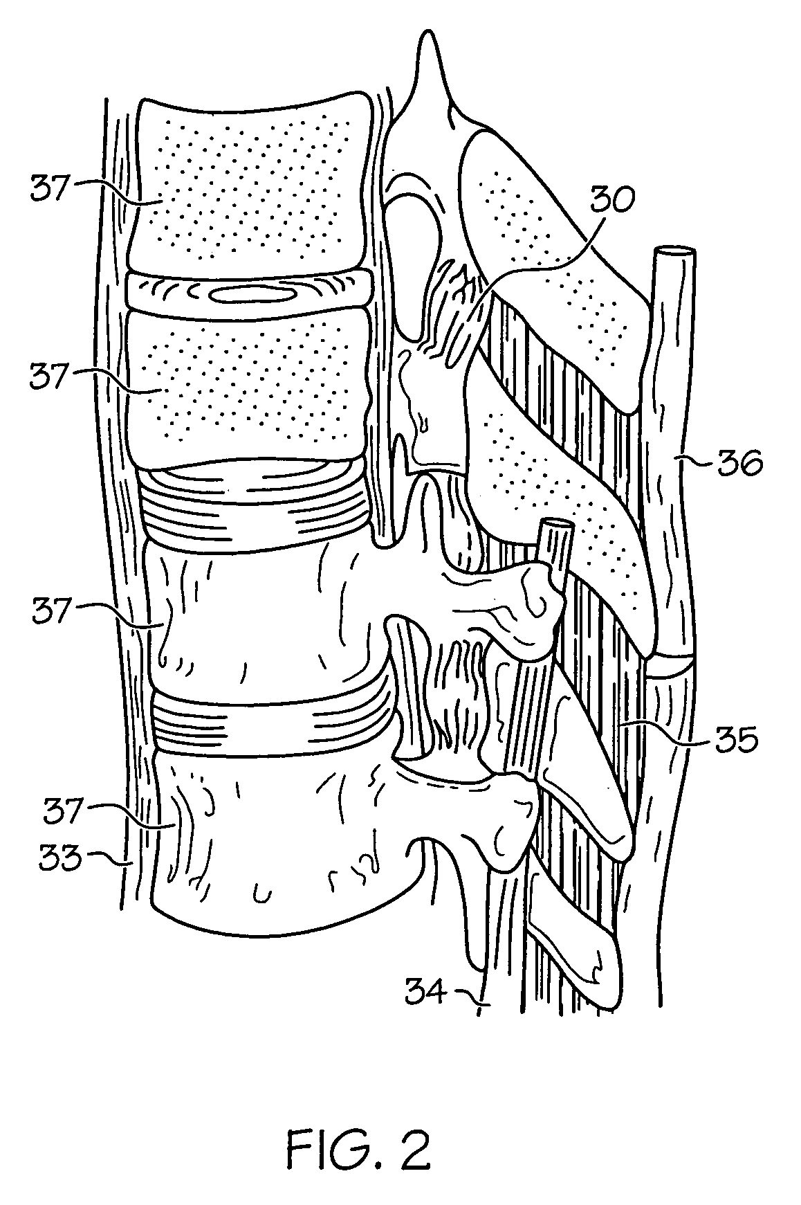 Medical lead and manufacturing method therefor