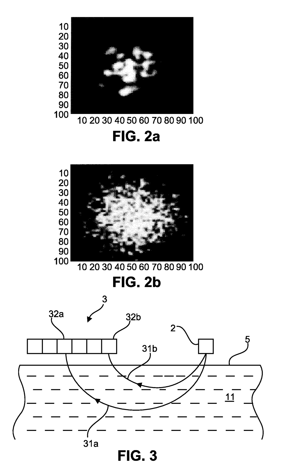 Optical laser speckle sensor for measuring a blood perfusion parameter