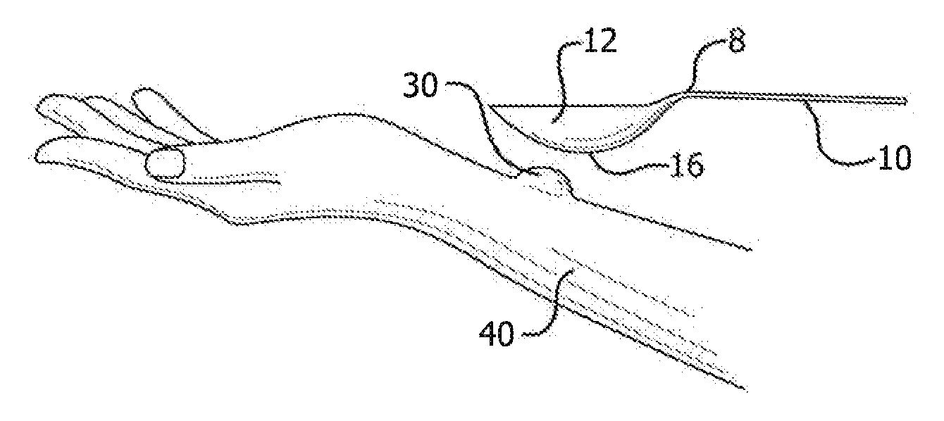 Method for Treating Poison Ivy and Similar Poison Plant Induced Rashes