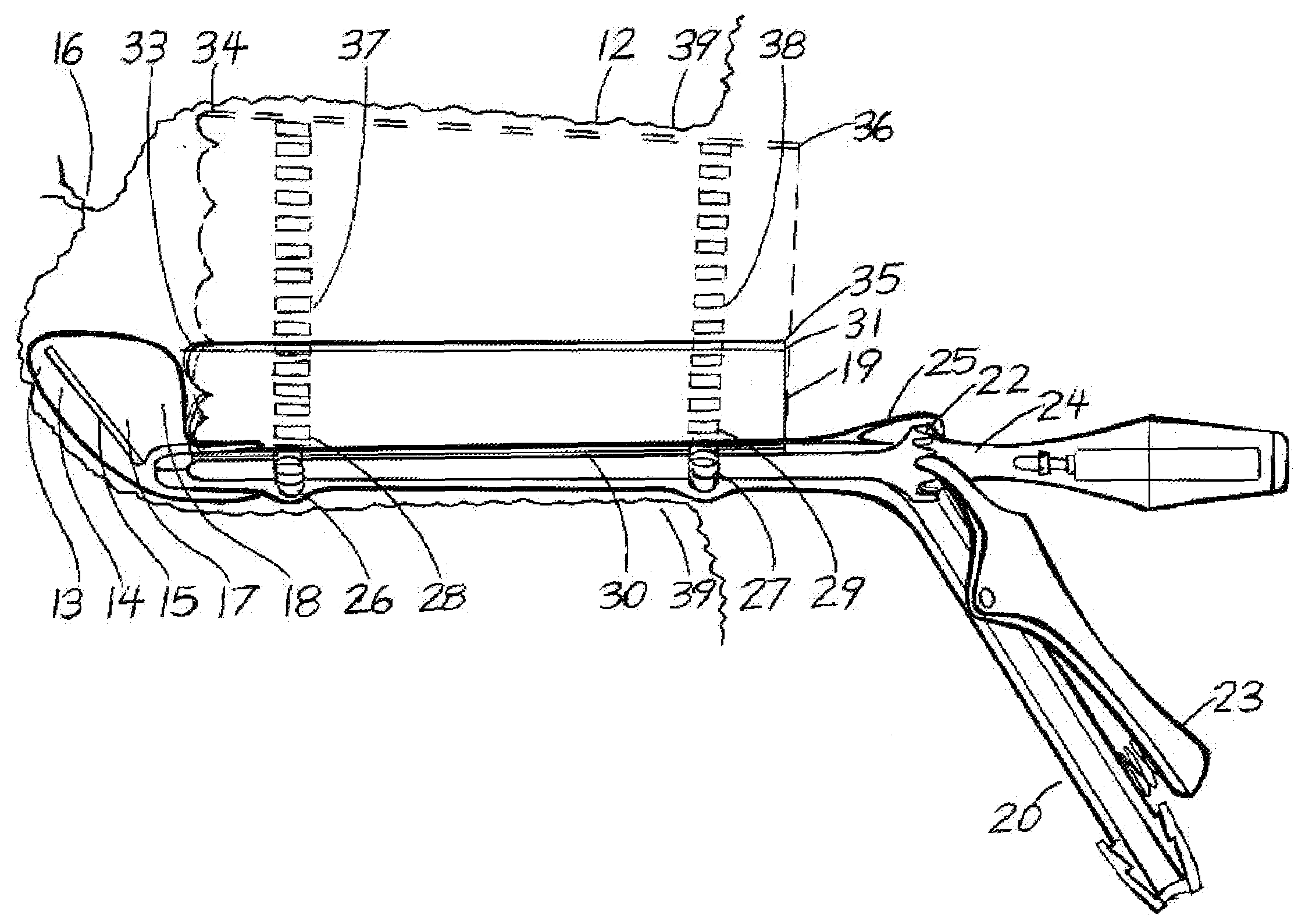 Tunnel vision gynocological examination device