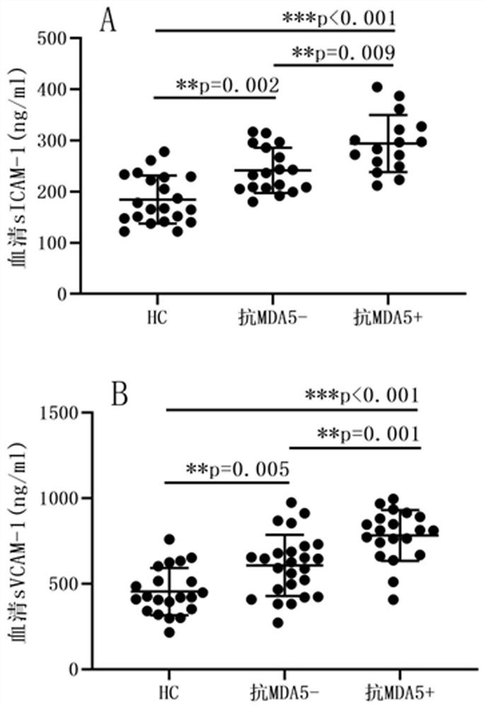 Molecular marker for diagnosing anti-MDA5 positive dermatomyositis and application thereof