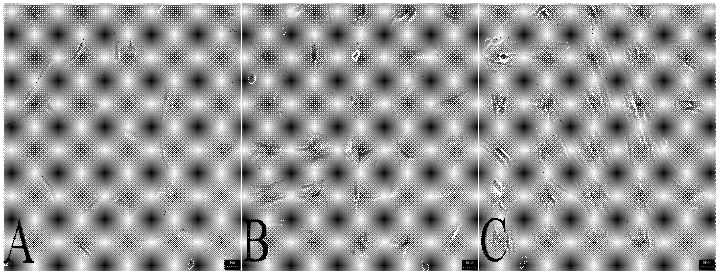 Method for culturing human embryo stem cell by using umbilical cord source mesenchymal stem cell