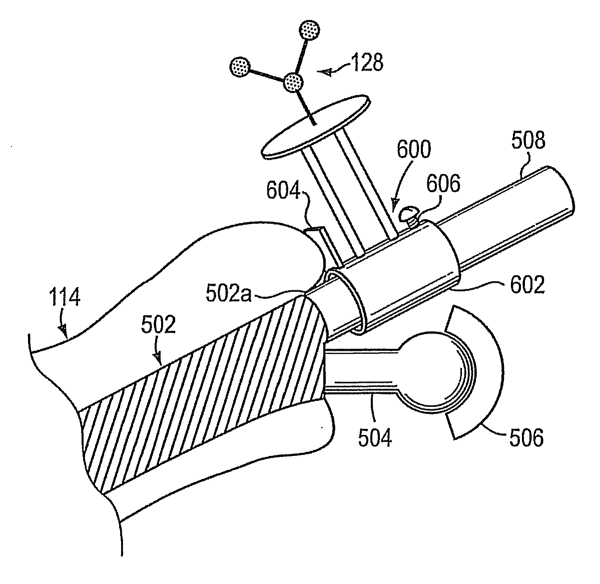 System and method for facilitating hip surgery