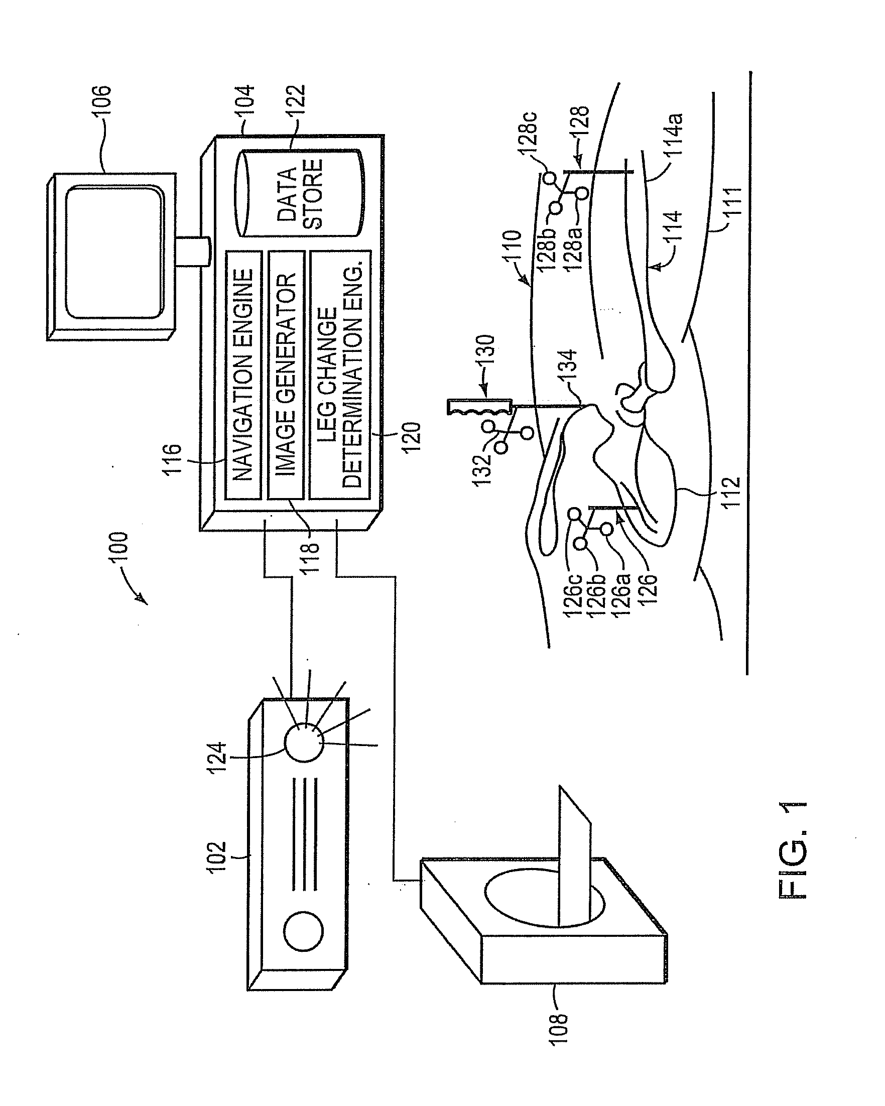 System and method for facilitating hip surgery