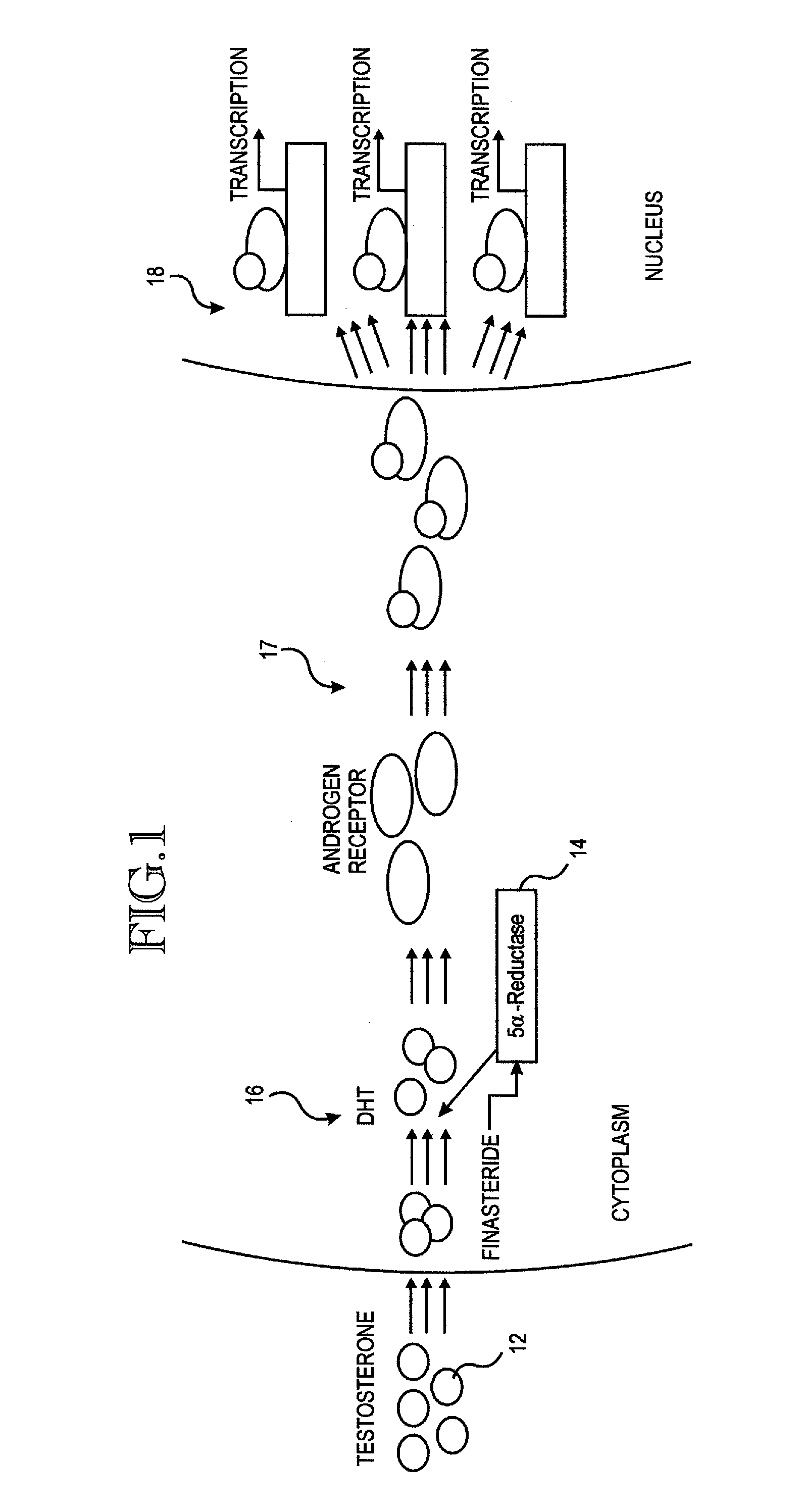 Method and kit for treatment/prevention of hair loss