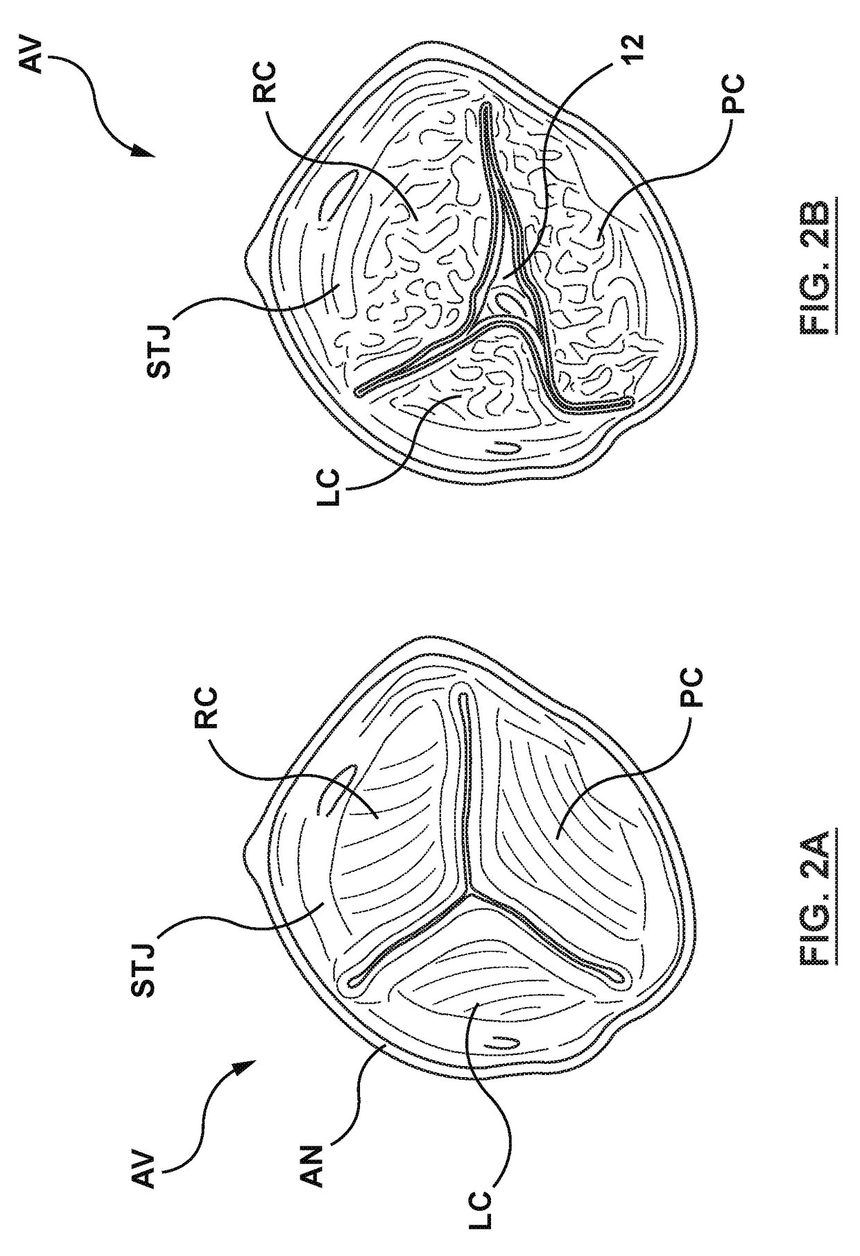 Transcatheter guidewire delivery systems, catheter assemblies for guidewire delivery, and methods for percutaneous guidewire delivery across heart valves