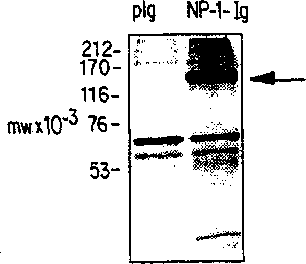 Novel NEUROPILIN/growth factor binding and use thereof